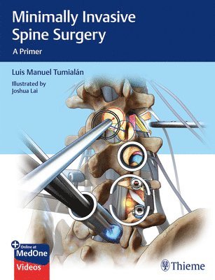 bokomslag Minimally Invasive Spine Surgery