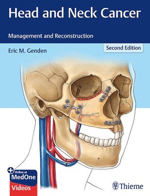 bokomslag Head and Neck Cancer