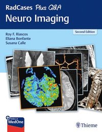 bokomslag RadCases Plus Q&A Neuro Imaging