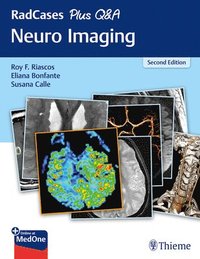 bokomslag RadCases Plus Q&a Neuro Imaging