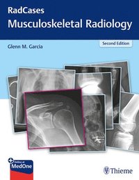 bokomslag RadCases Q&A Musculoskeletal Radiology
