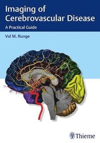 bokomslag Imaging of Cerebrovascular Disease