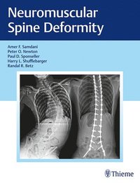 bokomslag Neuromuscular Spine Deformity