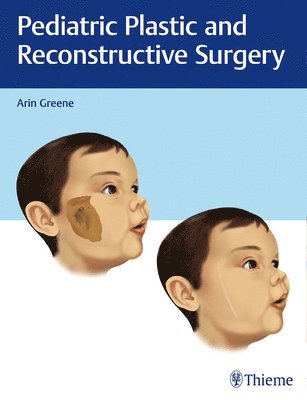 Pediatric Plastic and Reconstructive Surgery 1