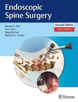 bokomslag Endoscopic Spine Surgery