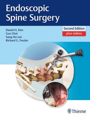 Endoscopic Spine Surgery 1