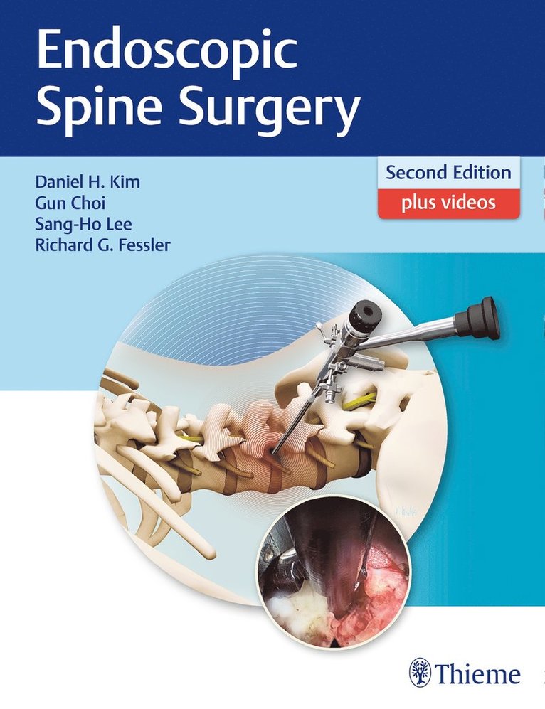 Daniel H. Kim, Gun Choi, Sang-Ho Lee, Richard Fessler, MD. Kim, Daniel H., Daniel H Kim - Endoscopic Spine Surgery, Inbunden
