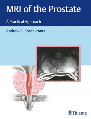 bokomslag MRI of the Prostate