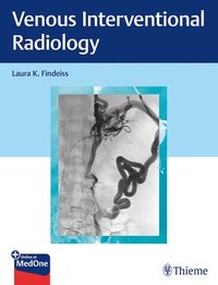 bokomslag Venous Interventional Radiology