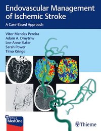 bokomslag Endovascular Management of Ischemic Stroke