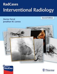 bokomslag RadCases Q&A Interventional Radiology