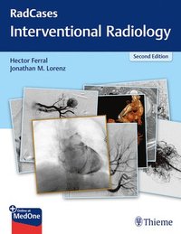 bokomslag RadCases Q&a Interventional Radiology