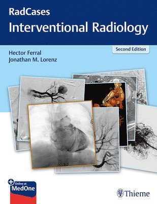 bokomslag RadCases Q&a Interventional Radiology