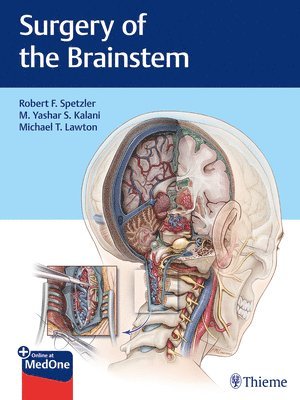 Surgery of the Brainstem 1