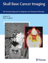 bokomslag Skull Base Cancer Imaging