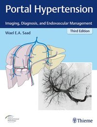 bokomslag Portal Hypertension