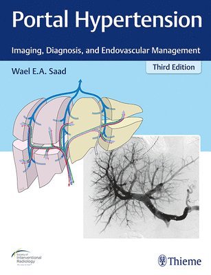 Portal Hypertension 1