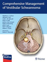 bokomslag Comprehensive Management of Vestibular Schwannoma