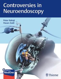 bokomslag Controversies in Neuroendoscopy