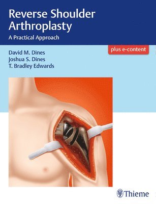 David M. Dines, Joshua Dines, T Bradley Edwards, David M Dines - Reverse Shoulder Arthroplasty, Inbunden