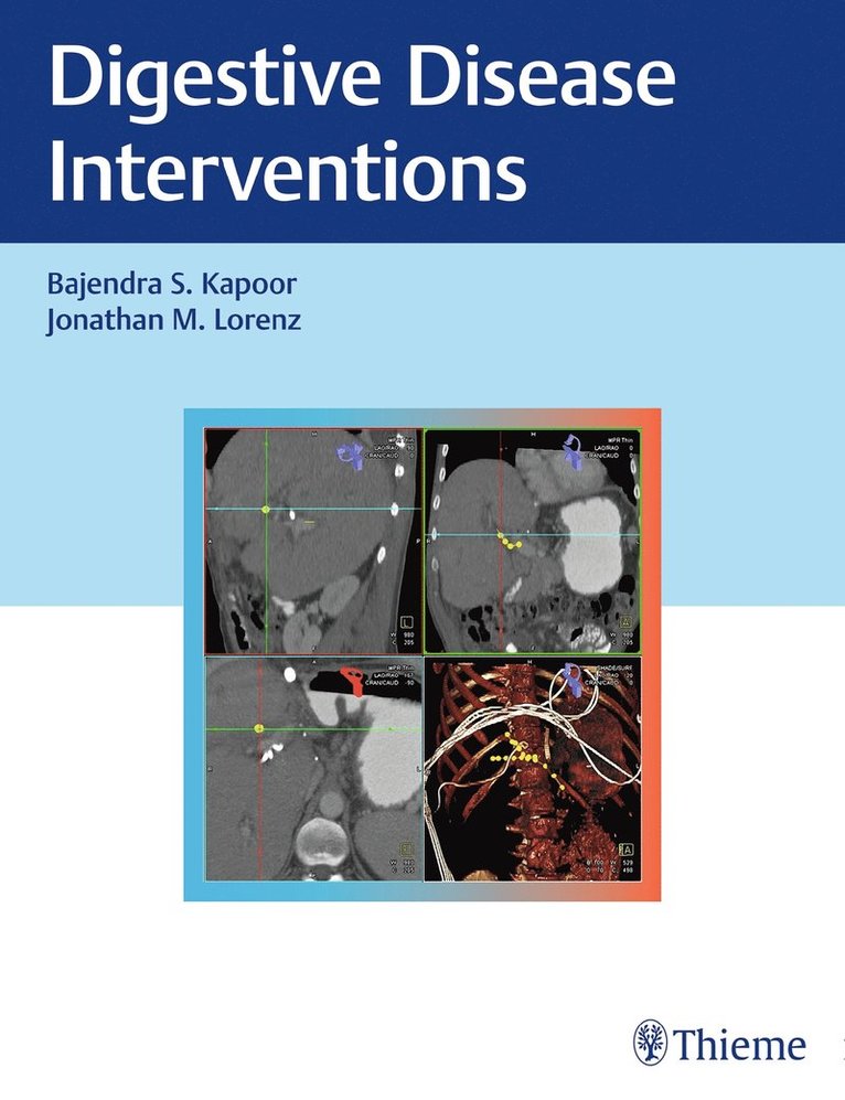 Baljendra Kapoor, Jonathan M. Lorenz, Jonathan M Lorenz - Digestive Disease Interventions, Inbunden
