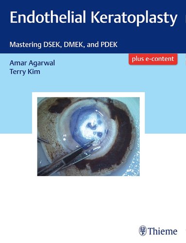 Amar Agarwal, Terry Kim - Endothelial Keratoplasty, Inbunden