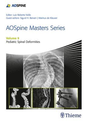 AOSpine Masters Series, Volume 9: Pediatric Spinal Deformities 1