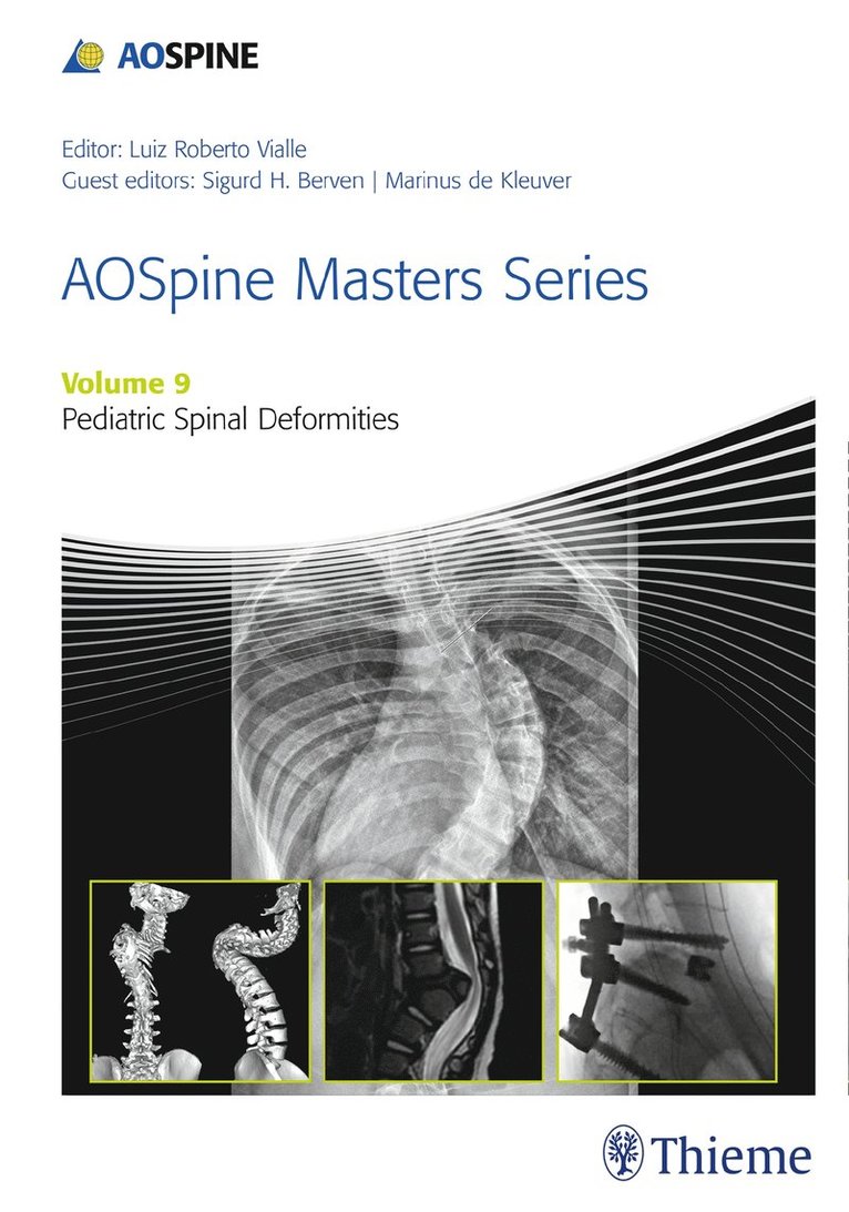 Sigurd Berven, Marinus de Kleuver, Luiz Vialle - AOSpine Masters Series, Volume 9: Pediatric Spinal Deformities, Inbunden