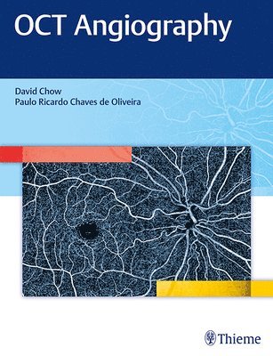 David Chow - OCT Angiography, Inbunden