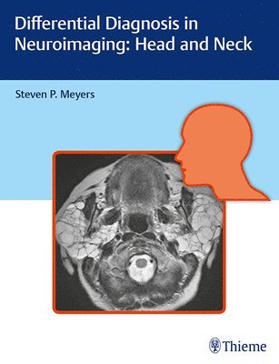 bokomslag Differential Diagnosis in Neuroimaging: Head and Neck