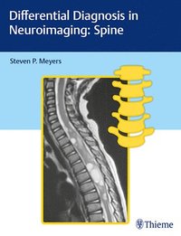 bokomslag Differential Diagnosis in Neuroimaging: Spine