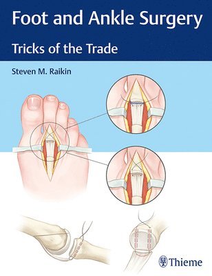 Foot and Ankle Surgery 1