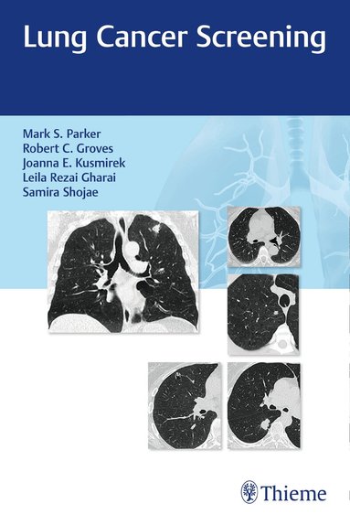 Mark Parker, Robert Groves, Joanna Kusmirek, Leila Rezai Gharai, Samira Shojaee - Lung Cancer Screening, Häftad