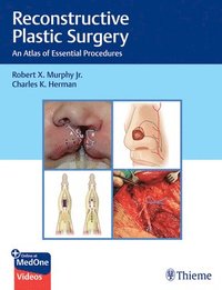 bokomslag Reconstructive Plastic Surgery