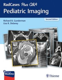 bokomslag RadCases Plus Q&A Pediatric Imaging