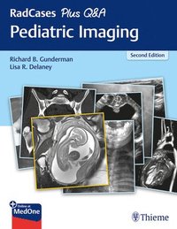 bokomslag RadCases Plus Q&a Pediatric Imaging