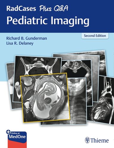 Richard B. Gunderman, Lisa Delaney - RadCases Plus Q&a Pediatric Imaging, Häftad