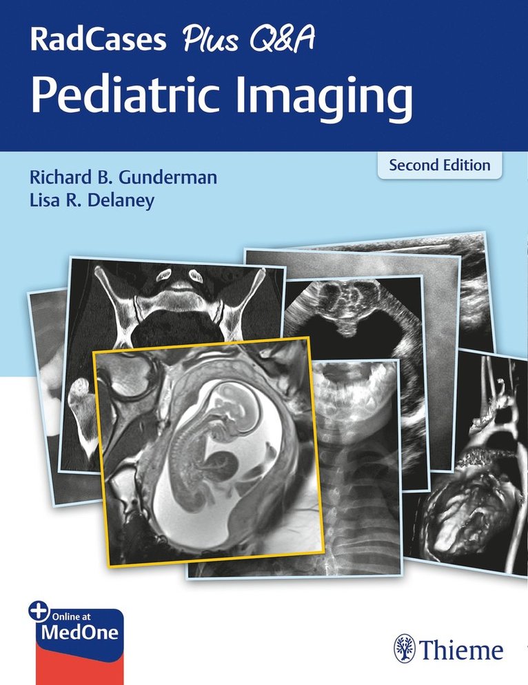 RadCases Plus Q&a Pediatric Imaging