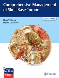 bokomslag Comprehensive Management of Skull Base Tumors