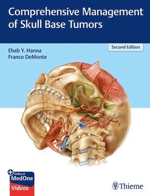 bokomslag Comprehensive Management of Skull Base Tumors