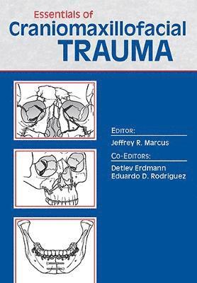 Jeffrey Marcus - Essentials of Craniomaxillofacial Trauma, Häftad