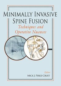 bokomslag Minimally Invasive Spine Fusion: Techniques and Operative Nuances