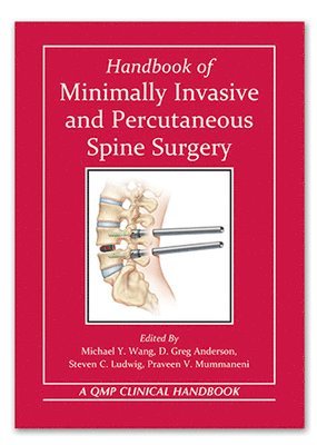 Handbook of Minimally Invasive and Percutaneous Spine Surgery 1