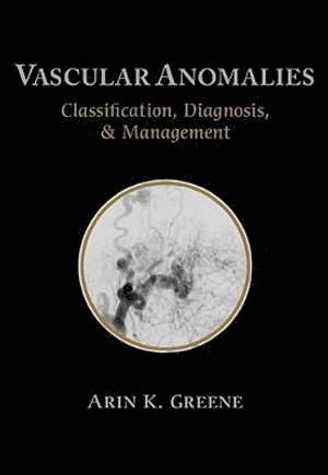 bokomslag Vascular Anomalies