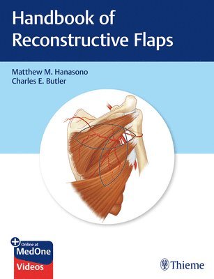 Handbook of Reconstructive Flaps 1