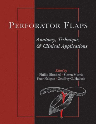 Perforator Flaps 1