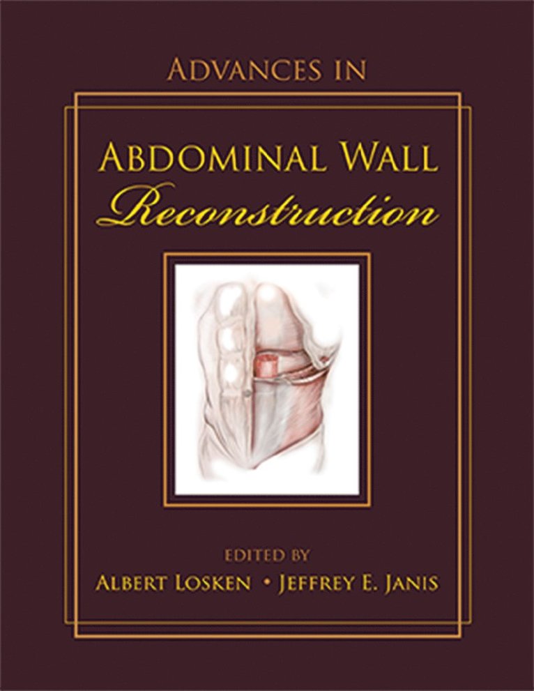 Albert Losken, Jeffrey Janis, FACS Losken, Albert, MD. - Advances in Abdominal Wall Reconstruction, Inbunden