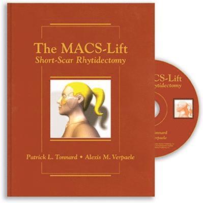 The MACS-Lift 1