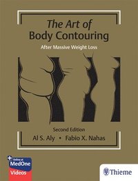 bokomslag The Art of Body Contouring: After Massive Weight Loss