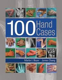 bokomslag 100 Hand Cases